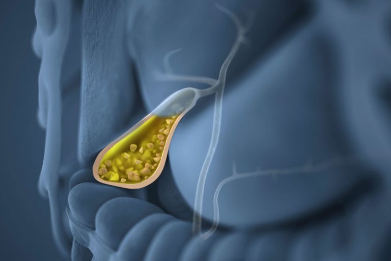 Prof. Dr. Selim Sarı: "Safradaki taş küçüldükçe ameliyat kaçınılmaz oluyor"